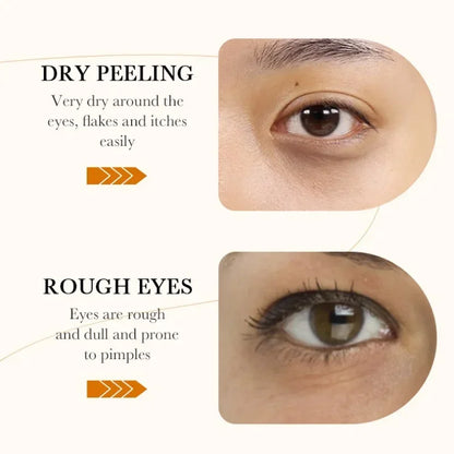 Eye Mask Anti Dark Circles Eyes Bags Remover Firming Moisturizing