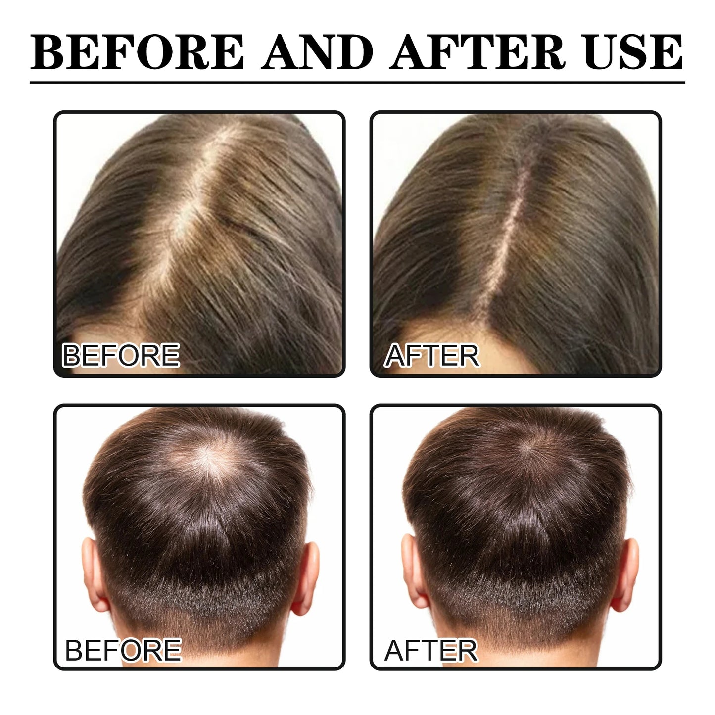 Hair care essence penetrates into the hair core fully absorbs nutrients deeply moisturizes Gentle smooth
